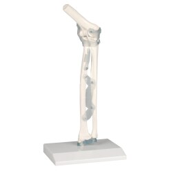 Erler Zimmer® Ellenbogengelenk mit Bändern